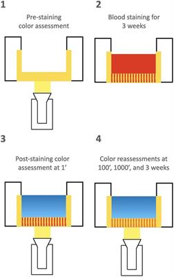 In vitro and ex vivo comparison of reactive oxygen-releasing granules for internal tooth bleaching